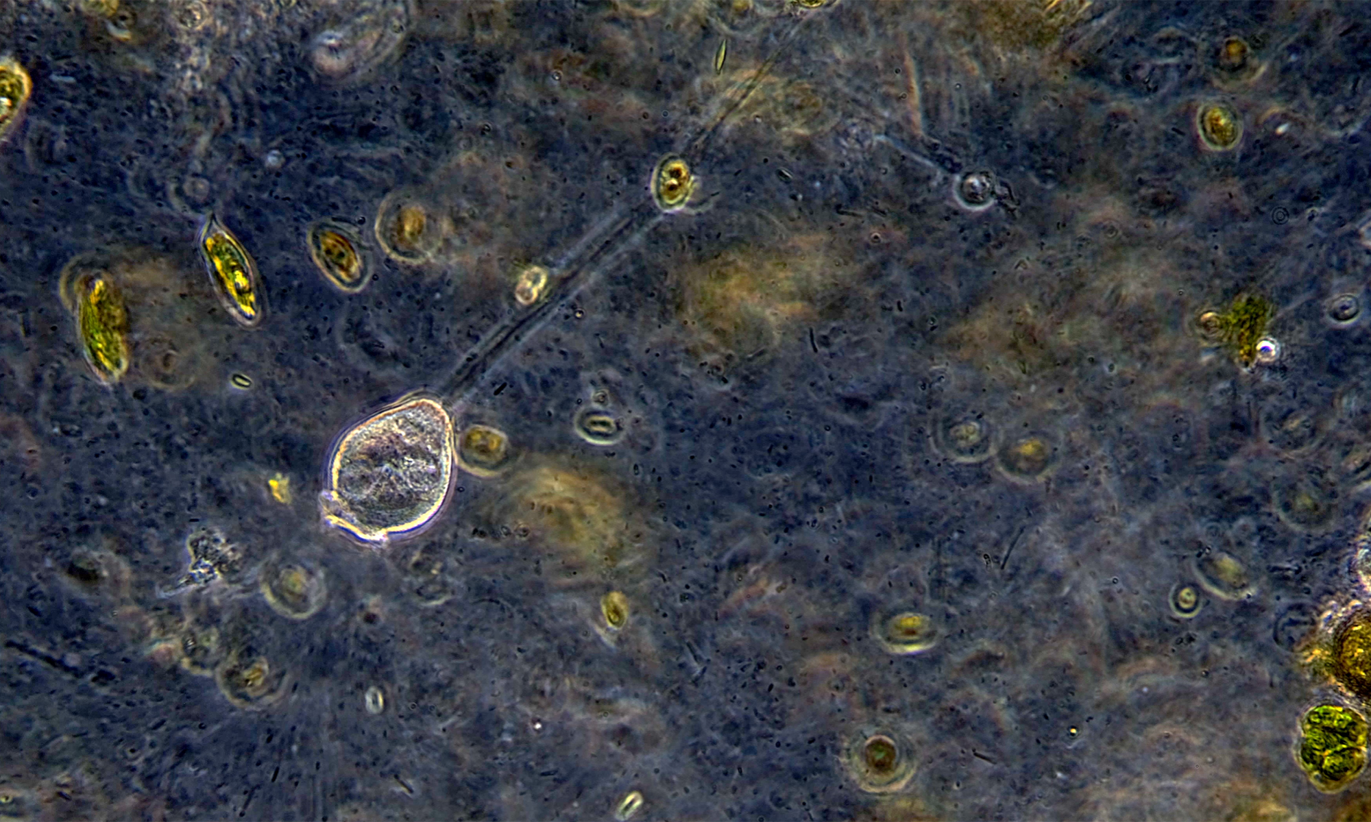 Vorticella